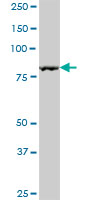 Western blot - Anti-SPIN90 antibody (AB88467), expandable thumbnail