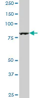 Western blot - Anti-SPIN90 antibody (AB88467)