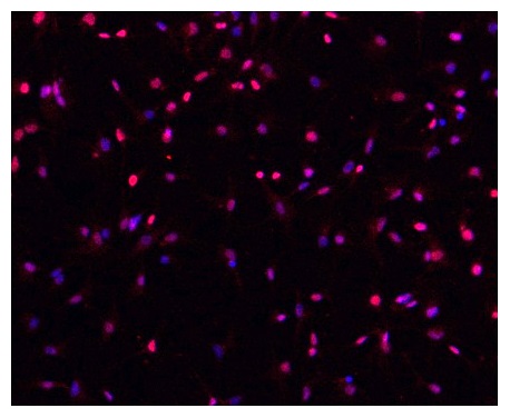Immunocytochemistry/ Immunofluorescence - Spinal Astrocytes  - Human iPSC derived cells (Male, WC-30) (AB315370), expandable thumbnail