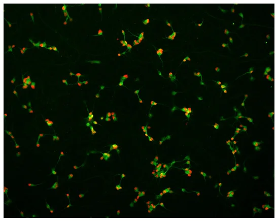 Immunocytochemistry/ Immunofluorescence - Spinal Motor Neuron - Human iPSC derived cells (GFP - expressing) (Male, WC-30) (AB315365)