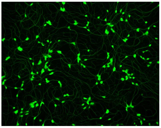 Immunocytochemistry/ Immunofluorescence - Spinal Motor Neuron - Human iPSC derived cells (GFP - expressing) (Male, WC-30) (AB315365)