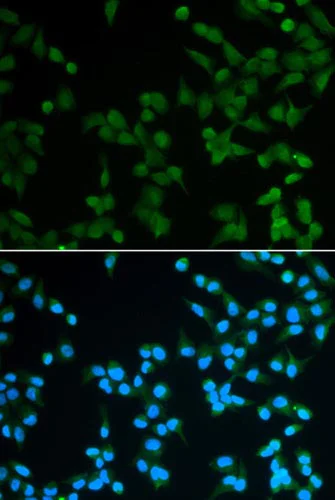 Immunocytochemistry/ Immunofluorescence - Anti-spindlin 1 antibody (AB196938)