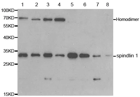 Western blot - Anti-spindlin 1 antibody (AB196938)
