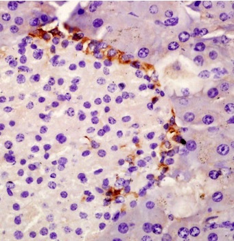 Immunohistochemistry (Formalin/PFA-fixed paraffin-embedded sections) - Anti-SPINK1/P12 antibody (AB203579)
