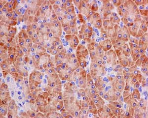 Immunohistochemistry (Formalin/PFA-fixed paraffin-embedded sections) - Anti-SPINK1/P12 antibody [EPR12696(2)] (AB183034)