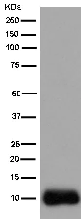 Western blot - Anti-SPINK1/P12 antibody [EPR12696(2)] - BSA and Azide free (AB250647)