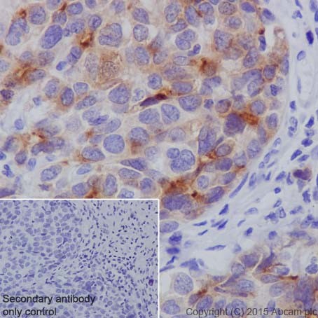 Immunohistochemistry (Formalin/PFA-fixed paraffin-embedded sections) - Anti-SPINK1/P12 antibody [EPR17585-116] (AB207302)