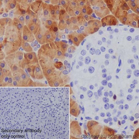 Immunohistochemistry (Formalin/PFA-fixed paraffin-embedded sections) - Anti-SPINK1/P12 antibody [EPR17585-116] (AB207302)