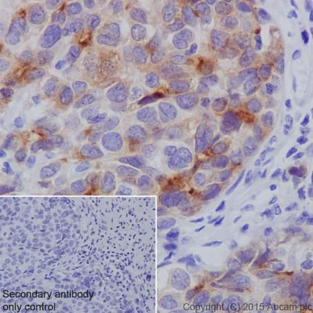 Immunohistochemistry (Formalin/PFA-fixed paraffin-embedded sections) - Anti-SPINK1/P12 antibody [EPR17585-116] - BSA and Azide free (AB251469)