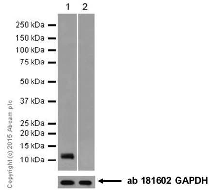 Western blot - Anti-SPINK1/P12 antibody [EPR17585-116] - BSA and Azide free (AB251469)