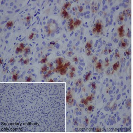 Immunohistochemistry (Formalin/PFA-fixed paraffin-embedded sections) - Anti-SPINK1/P12 antibody [EPR17585-30] (AB206294), expandable thumbnail
