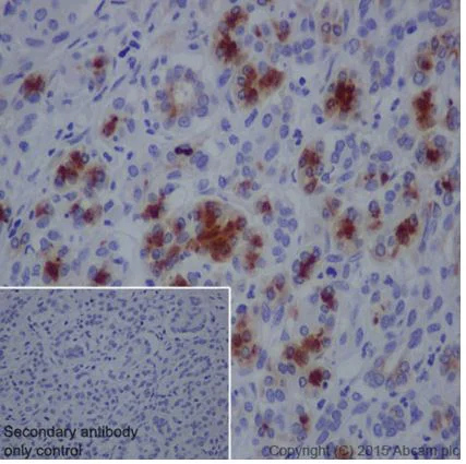 Immunohistochemistry (Formalin/PFA-fixed paraffin-embedded sections) - Anti-SPINK1/P12 antibody [EPR17585-30] (AB206294)