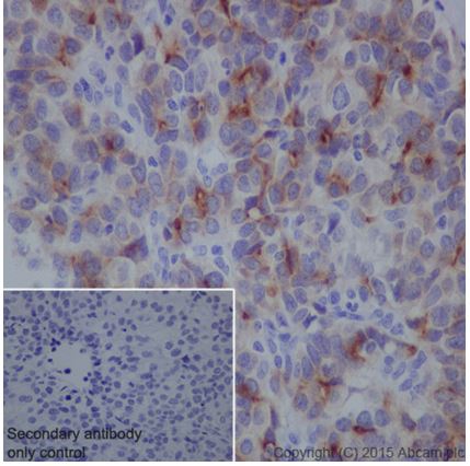 Immunohistochemistry (Formalin/PFA-fixed paraffin-embedded sections) - Anti-SPINK1/P12 antibody [EPR17585-30] (AB206294), expandable thumbnail