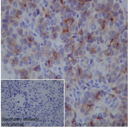 Immunohistochemistry (Formalin/PFA-fixed paraffin-embedded sections) - Anti-SPINK1/P12 antibody [EPR17585-30] (AB206294)