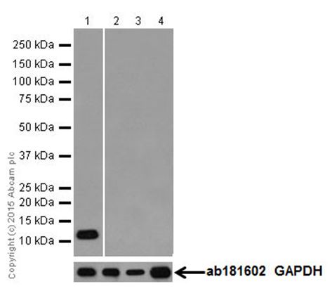 Western blot - Anti-SPINK1/P12 antibody [EPR17585-30] (AB206294), expandable thumbnail