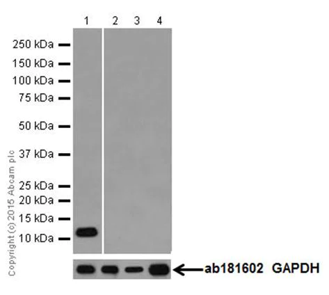 Western blot - Anti-SPINK1/P12 antibody [EPR17585-30] (AB206294)