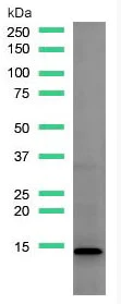 Western blot - Anti-SPINK1/P12 antibody [SP166] (AB183347)