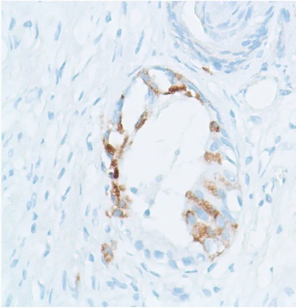 Immunohistochemistry (Formalin/PFA-fixed paraffin-embedded sections) - Anti-SPINK1/P12 antibody [SP166] - BSA and Azide free (AB271943)