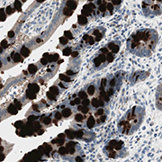 Immunohistochemistry (Formalin/PFA-fixed paraffin-embedded sections) - Anti-SPINK4 antibody (AB121257)