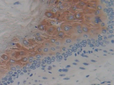 Immunohistochemistry (Formalin/PFA-fixed paraffin-embedded sections) - Anti-SPINK5/LEKTI antibody (AB231136)