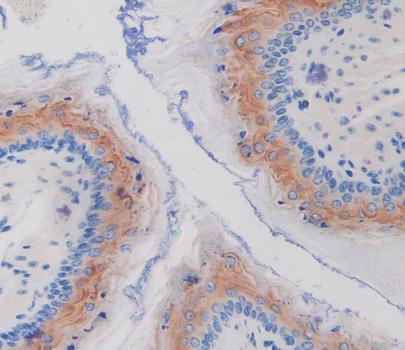 Immunohistochemistry (Formalin/PFA-fixed paraffin-embedded sections) - Anti-SPINK5/LEKTI antibody (AB231136)