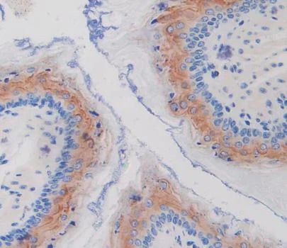 Immunohistochemistry (Formalin/PFA-fixed paraffin-embedded sections) - Anti-SPINK5/LEKTI antibody (AB231136)