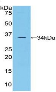 Western blot - Anti-SPINK5/LEKTI antibody (AB231136)