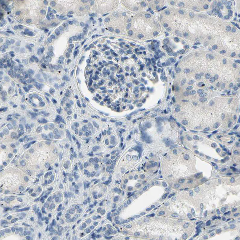 Immunohistochemistry (Formalin/PFA-fixed paraffin-embedded sections) - Anti-SPINK5/LEKTI antibody (AB246890)