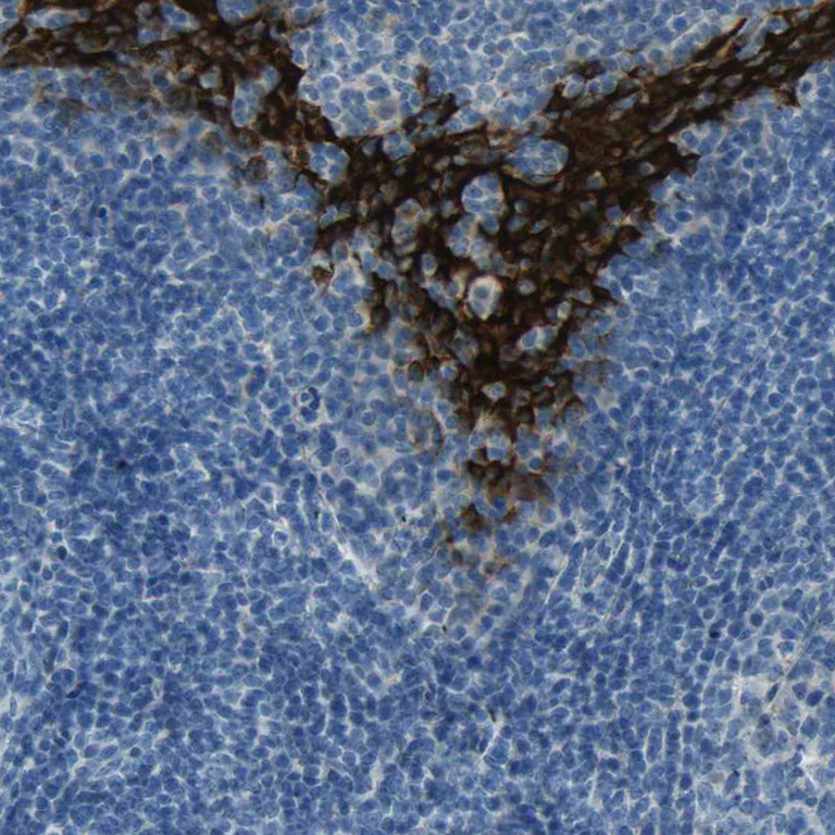 Immunohistochemistry (Formalin/PFA-fixed paraffin-embedded sections) - Anti-SPINK5/LEKTI antibody (AB246890)