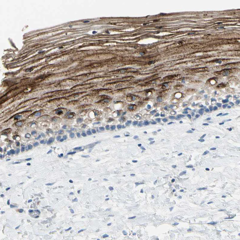 Immunohistochemistry (Formalin/PFA-fixed paraffin-embedded sections) - Anti-SPINK5/LEKTI antibody (AB246890)