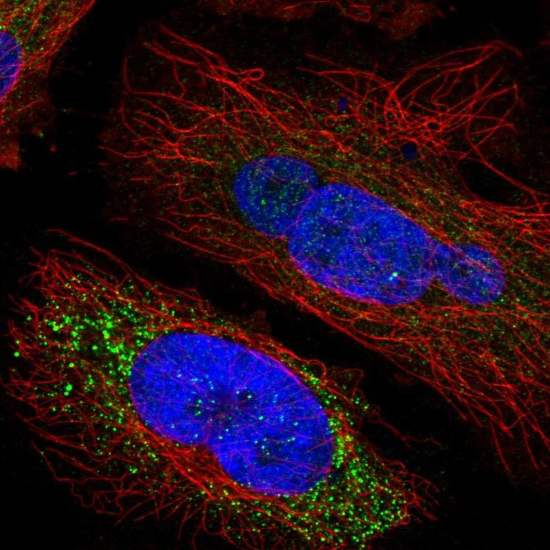 Immunocytochemistry/ Immunofluorescence - Anti-SPINK5/LEKTI antibody (AB246898)