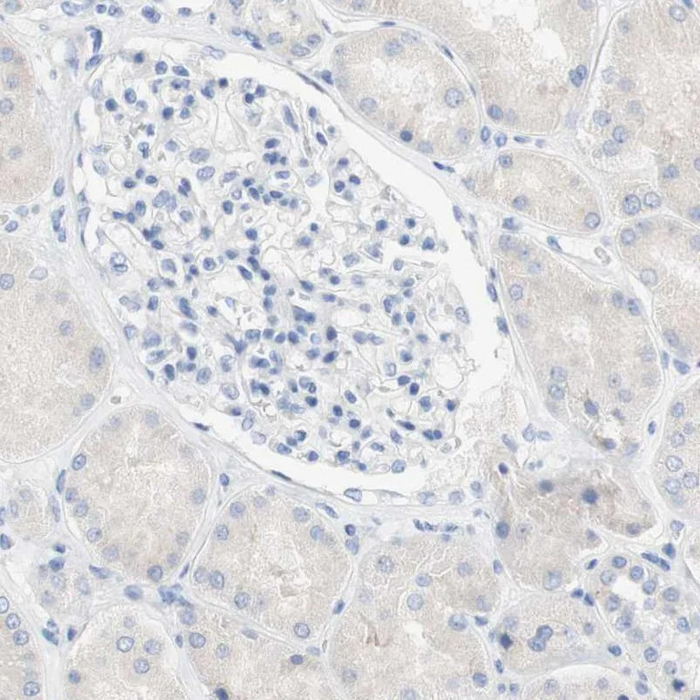 Immunohistochemistry (Formalin/PFA-fixed paraffin-embedded sections) - Anti-SPINK5/LEKTI antibody (AB246898)