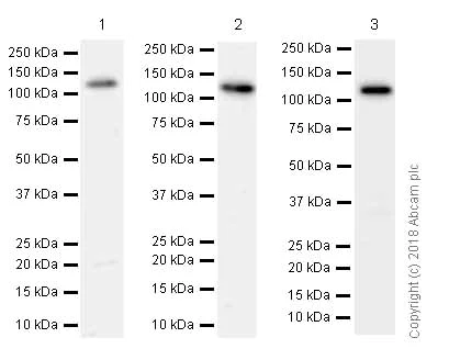 Western blot - Anti-SPINK5/LEKTI antibody [EPR8777] (AB138511)