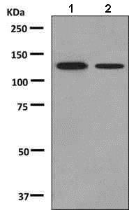 Western blot - Anti-SPINK5/LEKTI antibody [EPR8777] (AB138511), expandable thumbnail