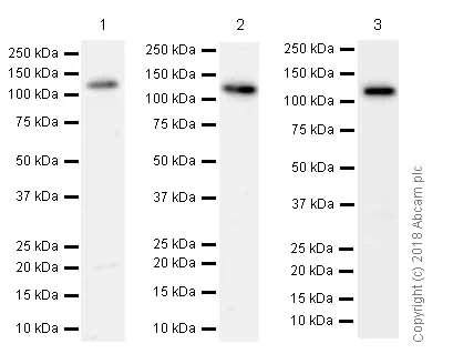 Western blot - Anti-SPINK5/LEKTI antibody [EPR8777] - BSA and Azide free (AB232501)
