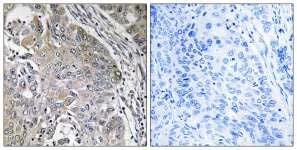 Immunohistochemistry (Formalin/PFA-fixed paraffin-embedded sections) - Anti-SPINK6 antibody (AB110830)