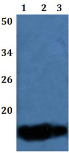 Western blot - Anti-SPINK6 antibody (AB201319), expandable thumbnail