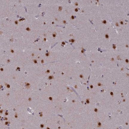 Immunohistochemistry (Formalin/PFA-fixed paraffin-embedded sections) - Anti-Spir-1 antibody (AB130403)