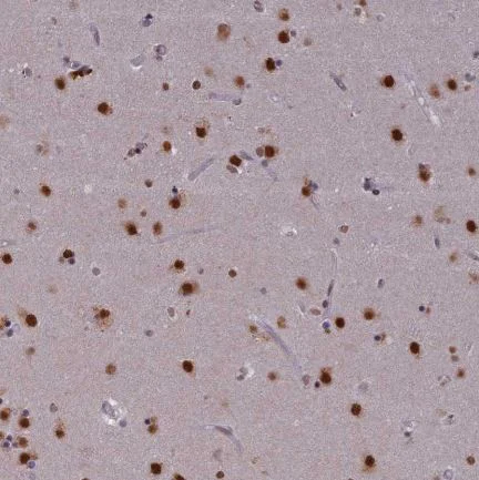Immunohistochemistry (Formalin/PFA-fixed paraffin-embedded sections) - Anti-Spir-1 antibody (AB130403)