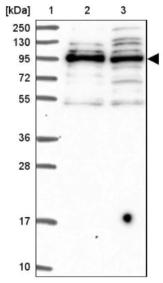 Western blot - Anti-Spir-1 antibody (AB130403)