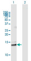 Western blot - Anti-sPLA2-IIE antibody (AB169045)