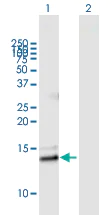 Western blot - Anti-sPLA2-IIE antibody (AB169045)