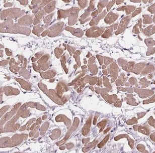 Immunohistochemistry (Formalin/PFA-fixed paraffin-embedded sections) - Anti-sPLA2-IIE antibody (AB204576)