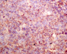 Immunohistochemistry (Formalin/PFA-fixed paraffin-embedded sections) - Anti-sPLA2-X antibody [EPR11202] - BSA and Azide free (AB249370), expandable thumbnail