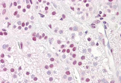 Immunohistochemistry (Formalin/PFA-fixed paraffin-embedded sections) - Anti-splicing factor 1 antibody (AB189274)