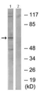 Western blot - Anti-splicing factor 1 antibody (AB189274)