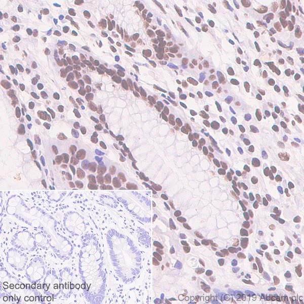 Immunohistochemistry (Formalin/PFA-fixed paraffin-embedded sections) - Anti-splicing factor 1 antibody [EPR22437-50] - BSA and Azide free (AB254199)