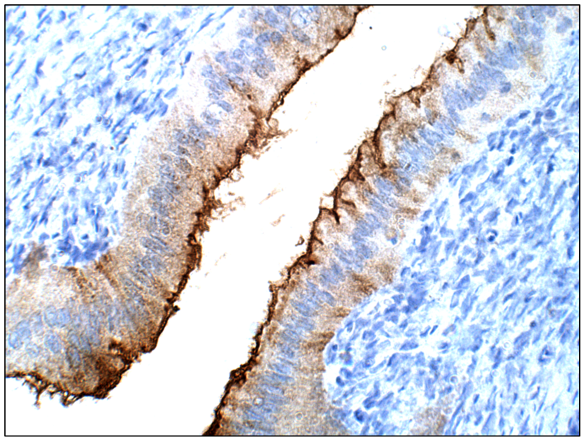 Immunohistochemistry (Formalin/PFA-fixed paraffin-embedded sections) - Anti-SPNS2 antibody (AB82629)