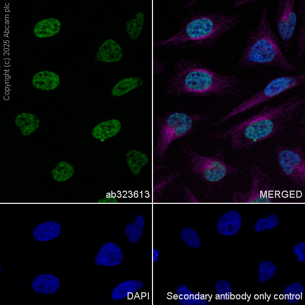 Immunocytochemistry/ Immunofluorescence - Anti-SPO11 antibody [EPR27077-81] (AB323613), expandable thumbnail