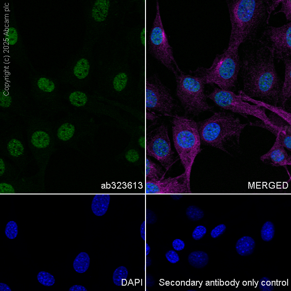 Immunocytochemistry/ Immunofluorescence - Anti-SPO11 antibody [EPR27077-81] (AB323613), expandable thumbnail